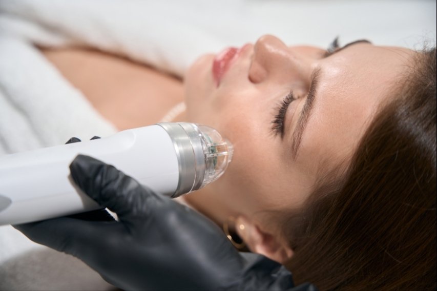 Microneedling Casablanca Dakhla - Régénération cutanée