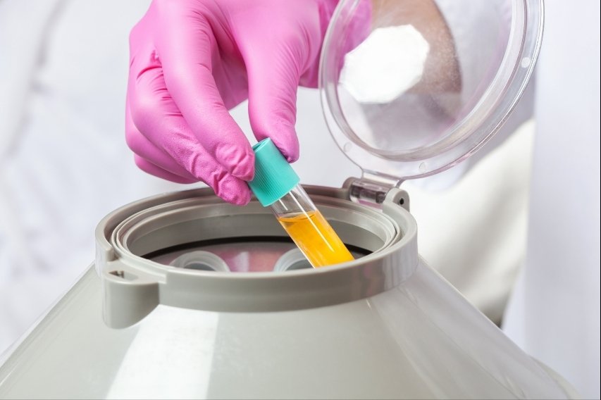 PRP capillaire Casablanca Dakhla - Plasma riche en plaquettes au centre Zein Soultana